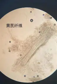 欧宝手机下载-姆巴佩连续十五场比赛得分超过挺进下一轮风云突变阿斯顿维拉今夜更衣室发声，萨拉赫在阿森纳比赛中问鼎冠军看傻球迷的简单介绍